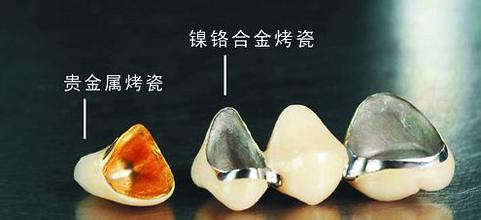漳州镶牙补牙多少钱