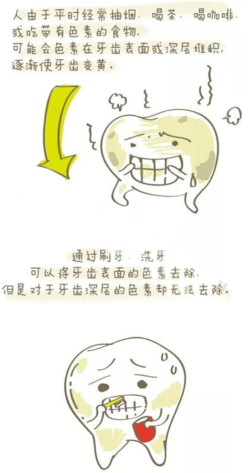 漳州冷光美白效果好吗