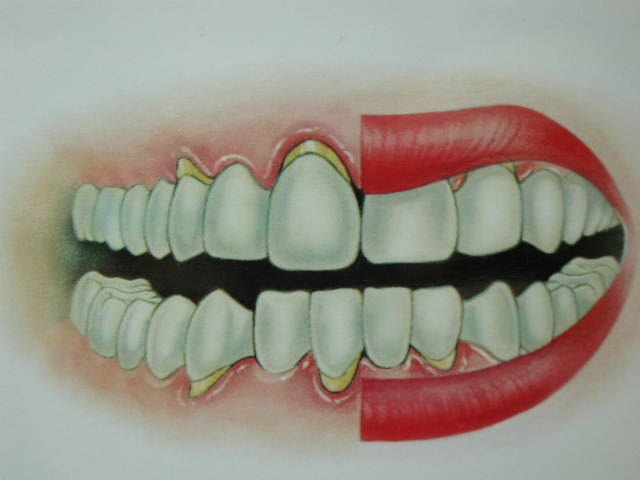 ݸԤή